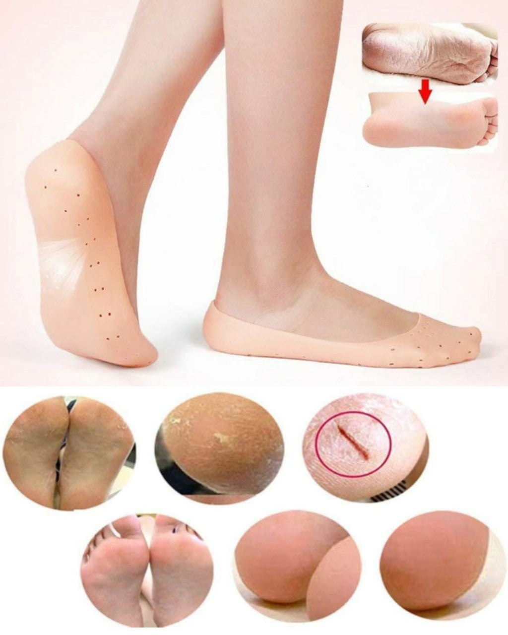 Smiling Foot Silicone Socks